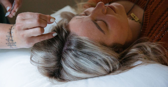 Acupuncture that works for women like you image